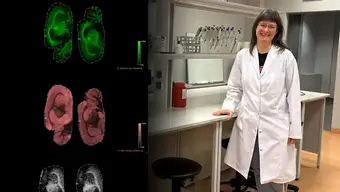 Prof. Anna Bodzoń-Kułakowska – naukowa podróż pełna odkryć